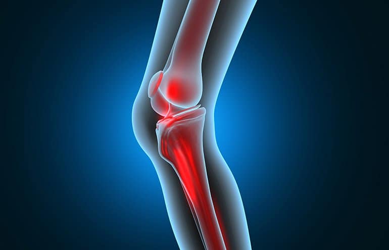 anatomical joint illustration