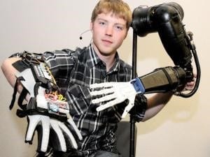 Unlimited Tomorrow designs personalized prosthetics to empower amputees