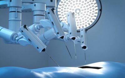 How motion engineering helps develop next-gen surgical robots