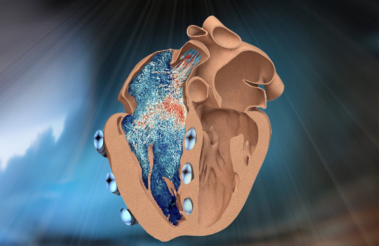 mit robot heart chamber