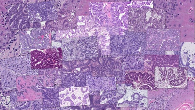 Predicting cancer type and drug response using histopathology images from the National Cancer Institute’s Patient-Derived Models Repository.