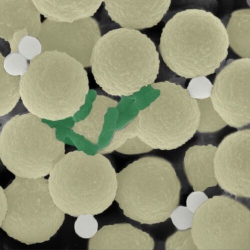 | PACE Engineering Recruiters A microscope image shows the microrobots yellow along with trapped bacteria green and tiny pieces of plastic white