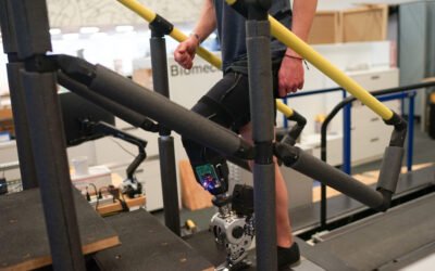 Brain-controlled prosthesis creates natural gait for amputees
