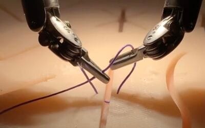 Researchers use imitation learning to train surgical robots