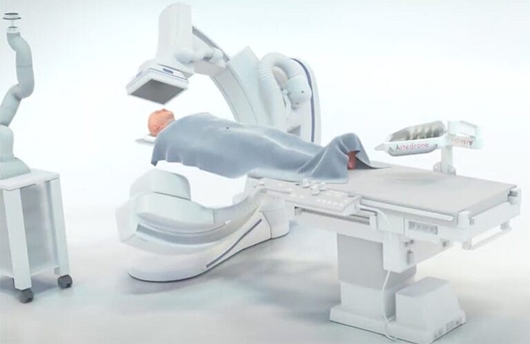 Artedrone designed its Sasha mechanical thrombectomy system to use magnets and robotics to help the catheter retrieve a stroke patient’s blood clot.